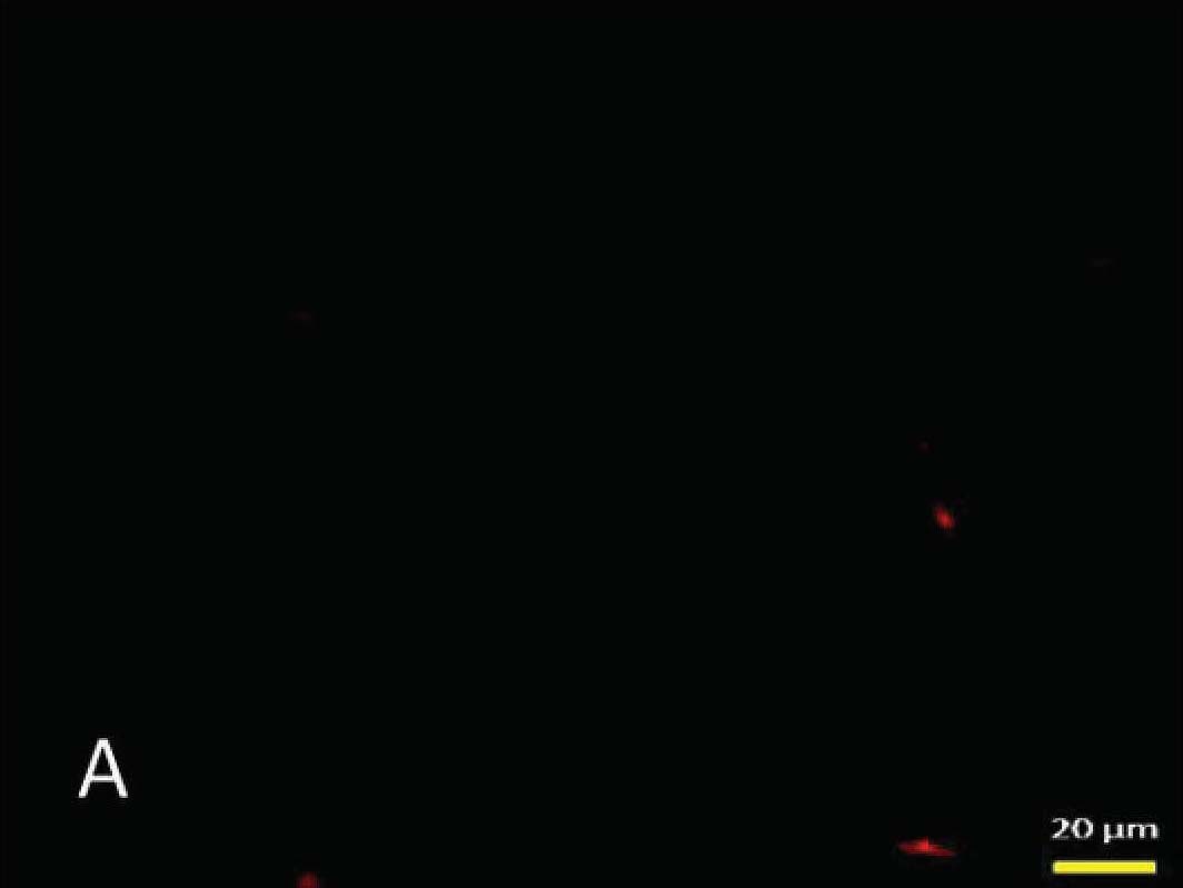 缺氧預(yù)處理減少新生小鼠缺氧缺血性腦病腦組織細(xì)胞凋亡